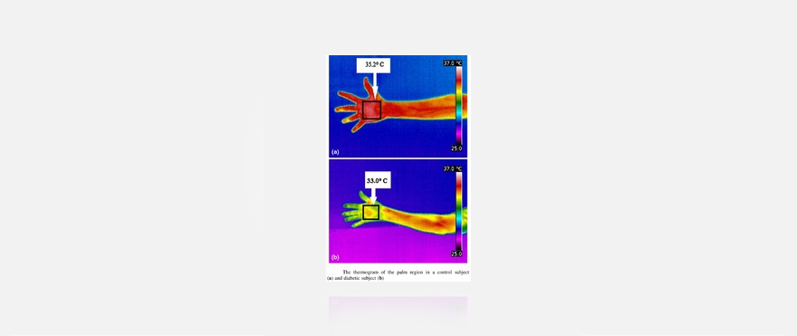 IR Thermal Imager