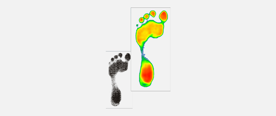 Podiascan Supplier Plantar Pressure Measurement Foot Pressure Sensor